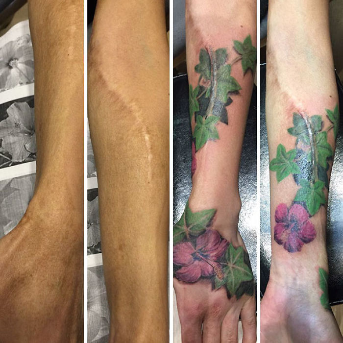 211 Amazing Tattoos That Turn Scars Into Works Of Art 211 Amazing Tattoos That Turn Scars Into Works Of Art