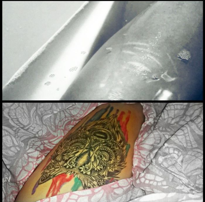 211 Amazing Tattoos That Turn Scars Into Works Of Art 211 Amazing Tattoos That Turn Scars Into Works Of Art