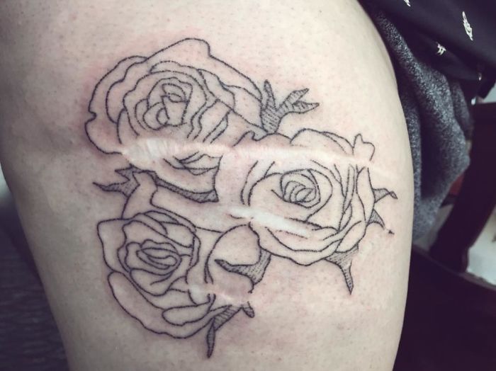 211 Amazing Tattoos That Turn Scars Into Works Of Art 211 Amazing Tattoos That Turn Scars Into Works Of Art