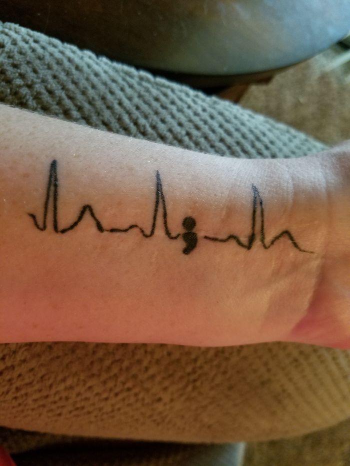 211 Amazing Tattoos That Turn Scars Into Works Of Art 211 Amazing Tattoos That Turn Scars Into Works Of Art