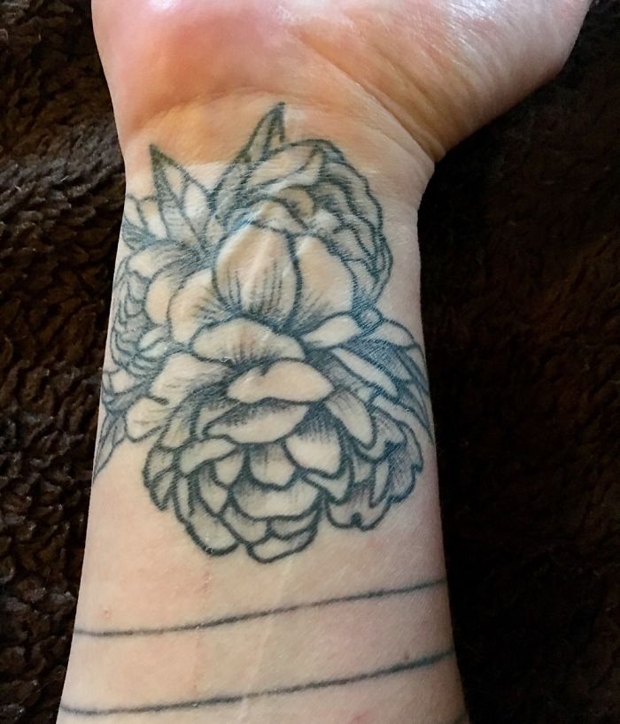 211 Amazing Tattoos That Turn Scars Into Works Of Art 211 Amazing Tattoos That Turn Scars Into Works Of Art