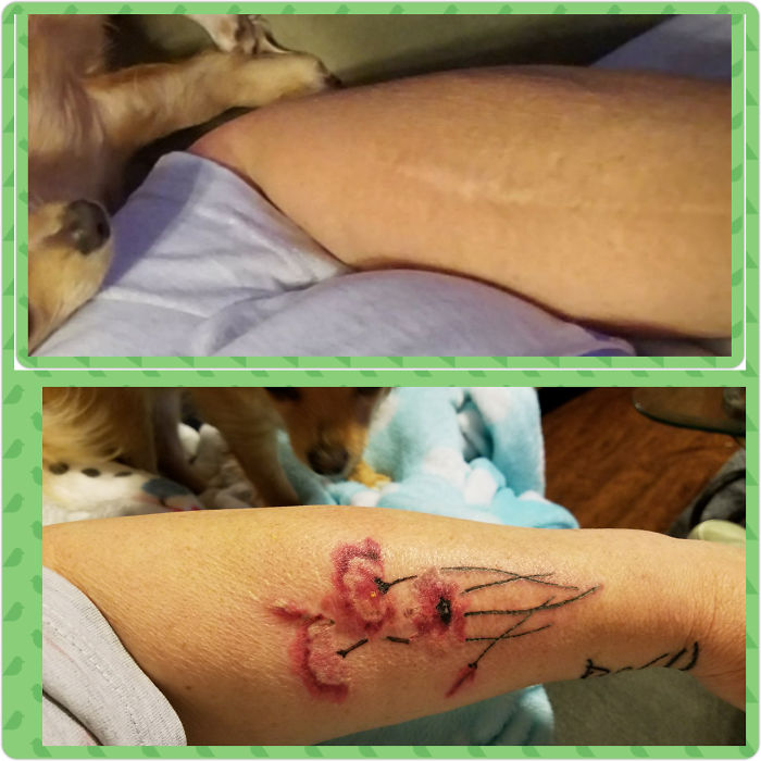 211 Amazing Tattoos That Turn Scars Into Works Of Art 211 Amazing Tattoos That Turn Scars Into Works Of Art