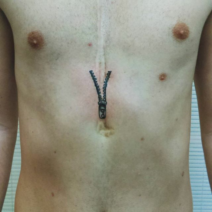 211 Amazing Tattoos That Turn Scars Into Works Of Art 211 Amazing Tattoos That Turn Scars Into Works Of Art