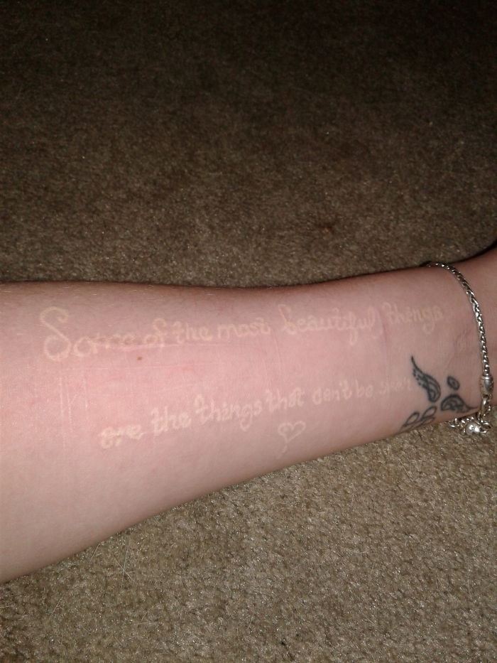 211 Amazing Tattoos That Turn Scars Into Works Of Art 211 Amazing Tattoos That Turn Scars Into Works Of Art