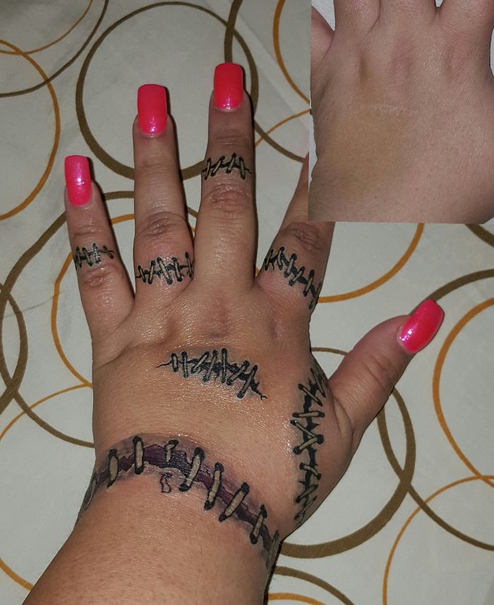 211 Amazing Tattoos That Turn Scars Into Works Of Art 211 Amazing Tattoos That Turn Scars Into Works Of Art