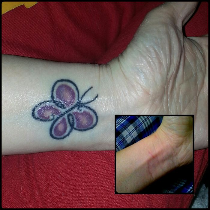 211 Amazing Tattoos That Turn Scars Into Works Of Art 211 Amazing Tattoos That Turn Scars Into Works Of Art