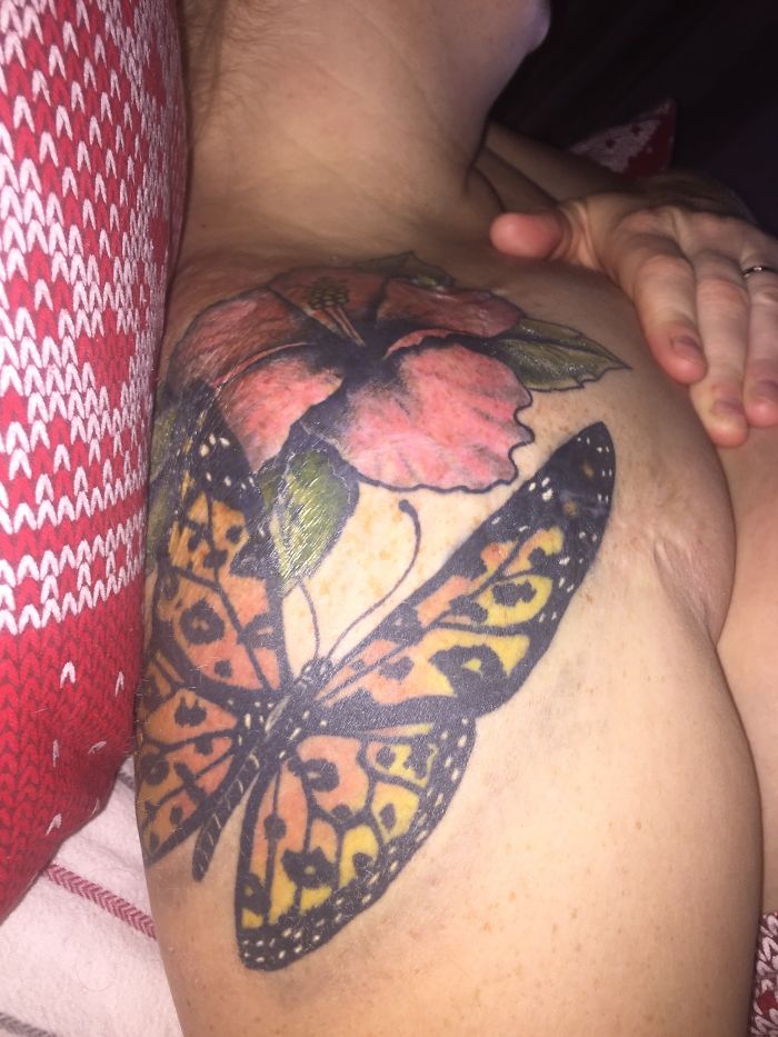 211 Amazing Tattoos That Turn Scars Into Works Of Art 211 Amazing Tattoos That Turn Scars Into Works Of Art