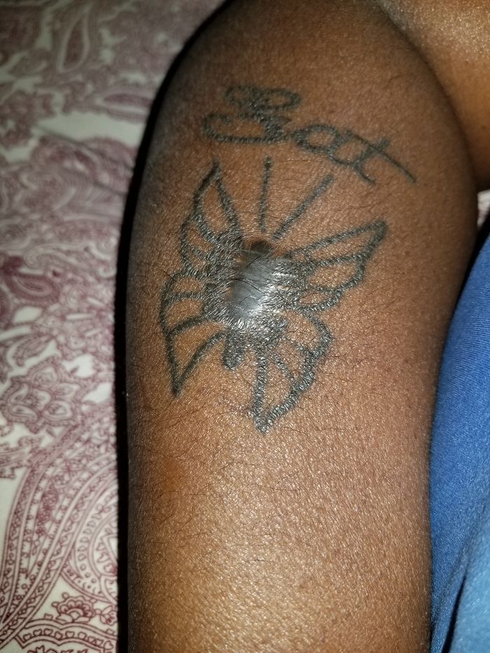 211 Amazing Tattoos That Turn Scars Into Works Of Art 211 Amazing Tattoos That Turn Scars Into Works Of Art