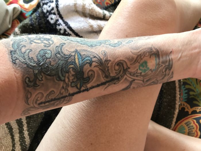 211 Amazing Tattoos That Turn Scars Into Works Of Art 211 Amazing Tattoos That Turn Scars Into Works Of Art