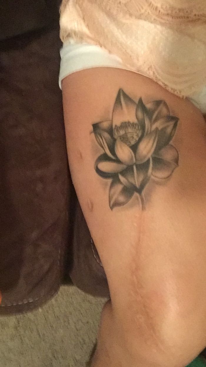 211 Amazing Tattoos That Turn Scars Into Works Of Art 211 Amazing Tattoos That Turn Scars Into Works Of Art