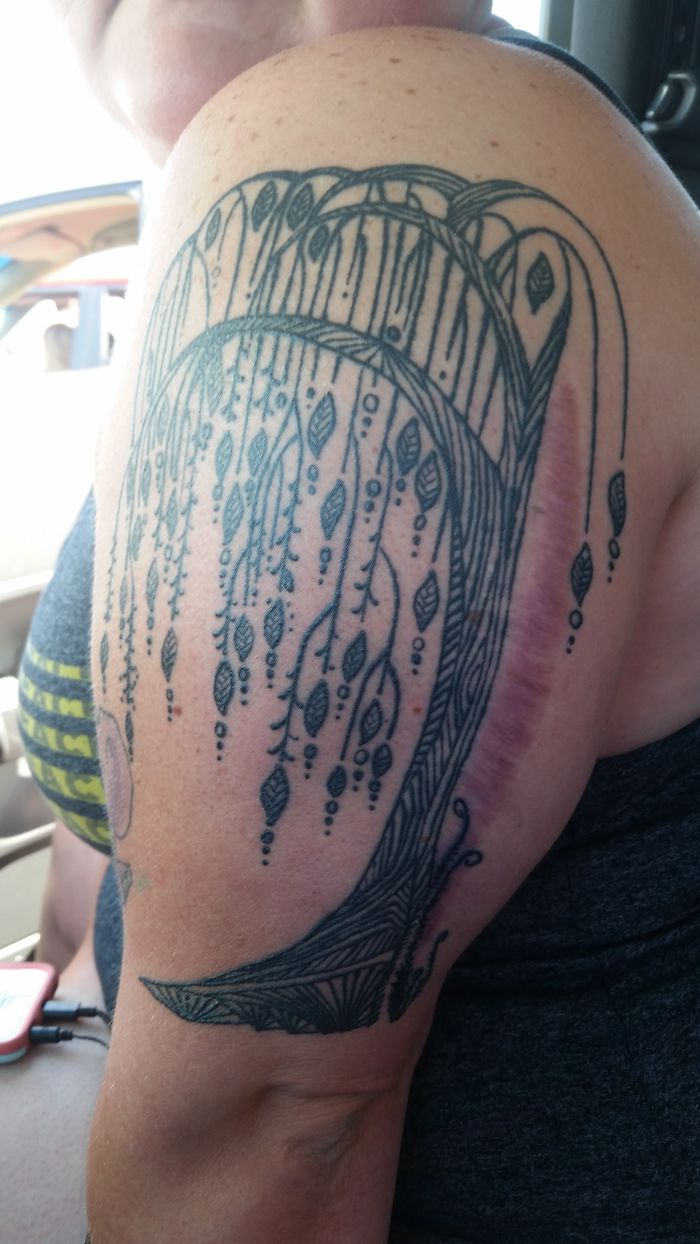 211 Amazing Tattoos That Turn Scars Into Works Of Art 211 Amazing Tattoos That Turn Scars Into Works Of Art
