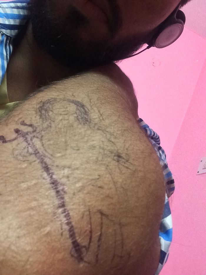 211 Amazing Tattoos That Turn Scars Into Works Of Art 211 Amazing Tattoos That Turn Scars Into Works Of Art