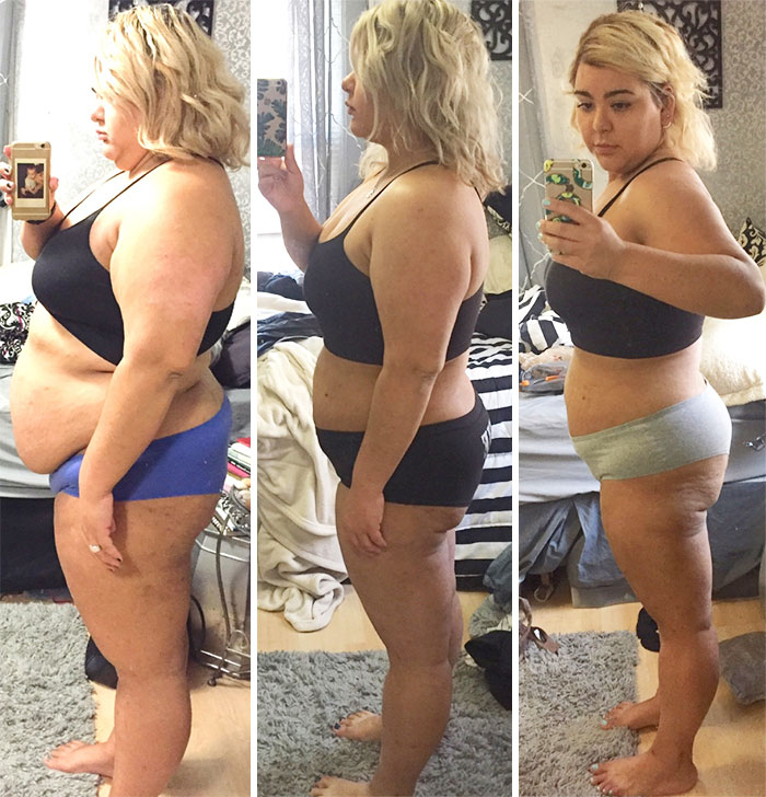 114 Incredible Before-And-After Weight Loss Pics You Won’t Believe Show The Same Person 114 Incredible Before-And-After Weight Loss Pics You Won’t Believe Show The Same Person