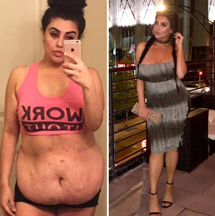 114 Incredible Before-And-After Weight Loss Pics You Won&#8217;t Believe Show The Same Person