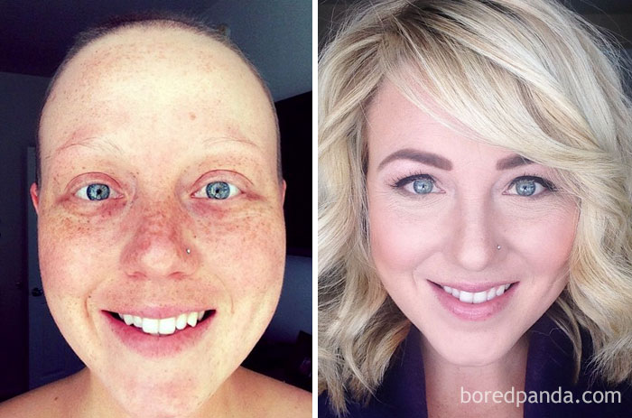 30 Incredible Before & After Pics Of People Who Beat Cancer That Will Make You Appreciate Life 30 Incredible Before & After Pics Of People Who Beat Cancer That Will Make You Appreciate Life