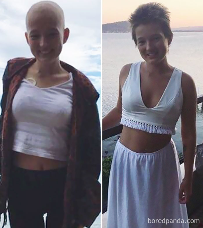 30 Incredible Before & After Pics Of People Who Beat Cancer That Will Make You Appreciate Life 30 Incredible Before & After Pics Of People Who Beat Cancer That Will Make You Appreciate Life