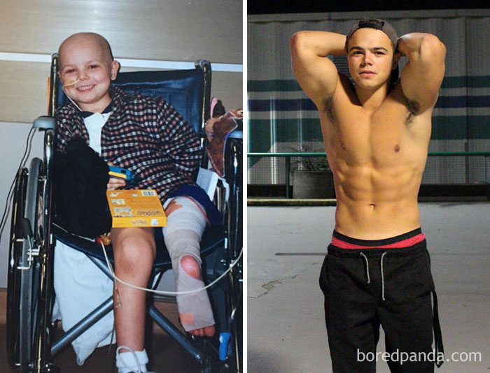 30 Incredible Before & After Pics Of People Who Beat Cancer That Will Make You Appreciate Life 30 Incredible Before & After Pics Of People Who Beat Cancer That Will Make You Appreciate Life