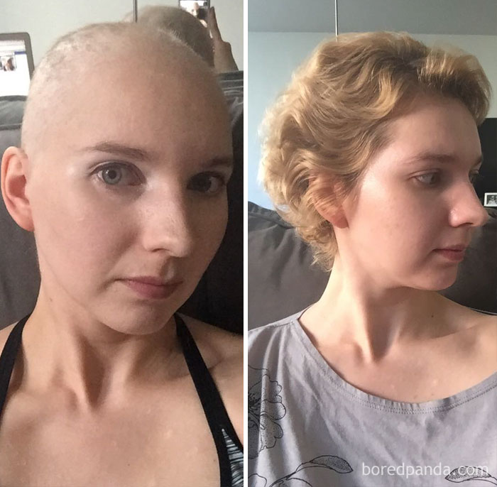 30 Incredible Before & After Pics Of People Who Beat Cancer That Will Make You Appreciate Life 30 Incredible Before & After Pics Of People Who Beat Cancer That Will Make You Appreciate Life