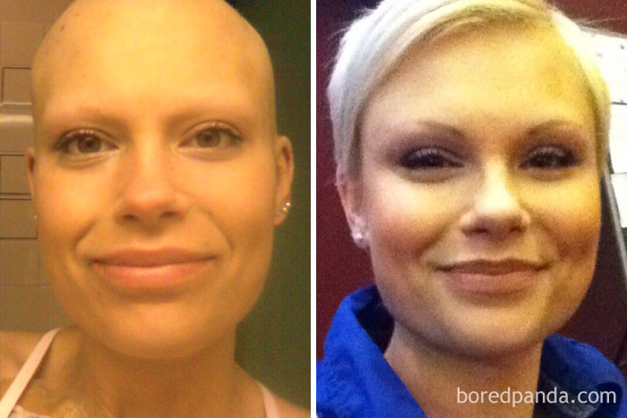 30 Incredible Before & After Pics Of People Who Beat Cancer That Will Make You Appreciate Life 30 Incredible Before & After Pics Of People Who Beat Cancer That Will Make You Appreciate Life
