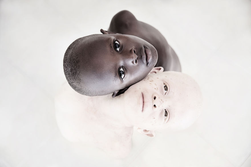 Stunning Photos Show The Beauty Of Albino Children To Raise Awareness Of Their Heartbreaking Situation In Tanzania Stunning Photos Show The Beauty Of Albino Children To Raise Awareness Of Their Heartbreaking Situation In Tanzania