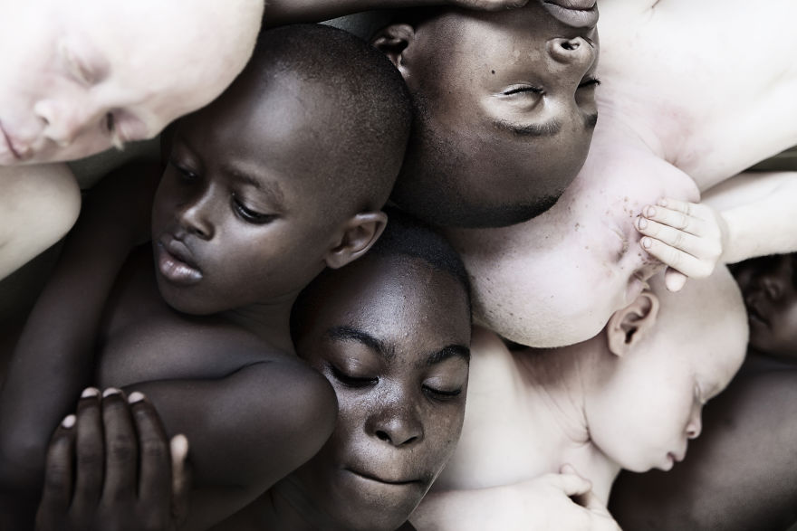 Stunning Photos Show The Beauty Of Albino Children To Raise Awareness Of Their Heartbreaking Situation In Tanzania Stunning Photos Show The Beauty Of Albino Children To Raise Awareness Of Their Heartbreaking Situation In Tanzania
