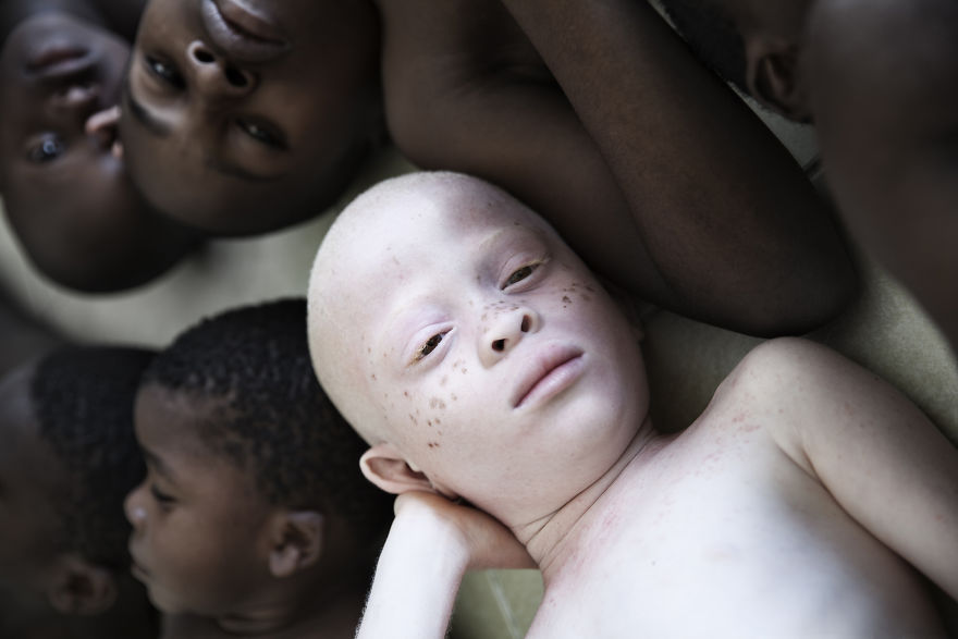 Stunning Photos Show The Beauty Of Albino Children To Raise Awareness Of Their Heartbreaking Situation In Tanzania Stunning Photos Show The Beauty Of Albino Children To Raise Awareness Of Their Heartbreaking Situation In Tanzania
