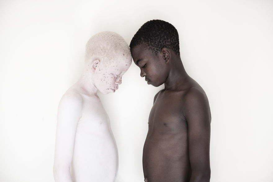 Stunning Photos Show The Beauty Of Albino Children To Raise Awareness Of Their Heartbreaking Situation In Tanzania Stunning Photos Show The Beauty Of Albino Children To Raise Awareness Of Their Heartbreaking Situation In Tanzania
