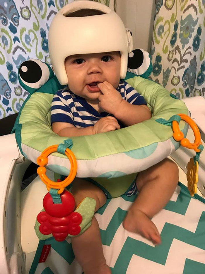 This Baby Has To Wear A Helmet So The Whole Family Decides To Step In This Baby Has To Wear A Helmet So The Whole Family Decides To Step In