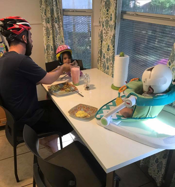 This Baby Has To Wear A Helmet So The Whole Family Decides To Step In This Baby Has To Wear A Helmet So The Whole Family Decides To Step In
