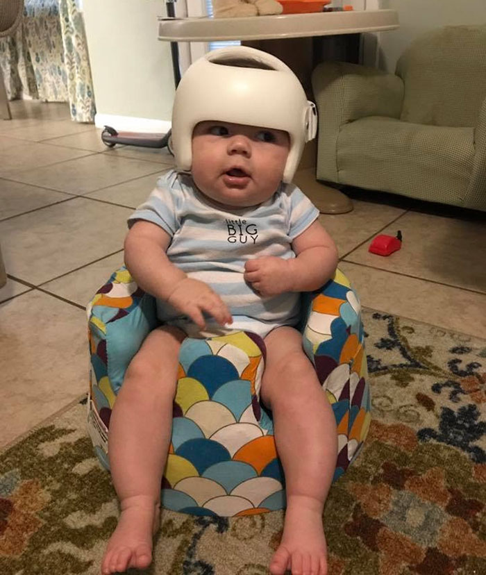 This Baby Has To Wear A Helmet So The Whole Family Decides To Step In This Baby Has To Wear A Helmet So The Whole Family Decides To Step In