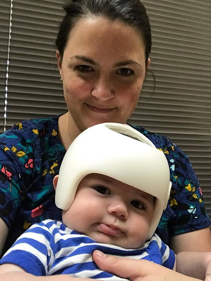 This Baby Has To Wear A Helmet So The Whole Family Decides To Step In This Baby Has To Wear A Helmet So The Whole Family Decides To Step In