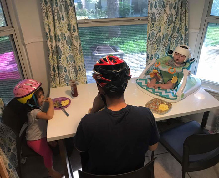 This Baby Has To Wear A Helmet So The Whole Family Decides To Step In This Baby Has To Wear A Helmet So The Whole Family Decides To Step In