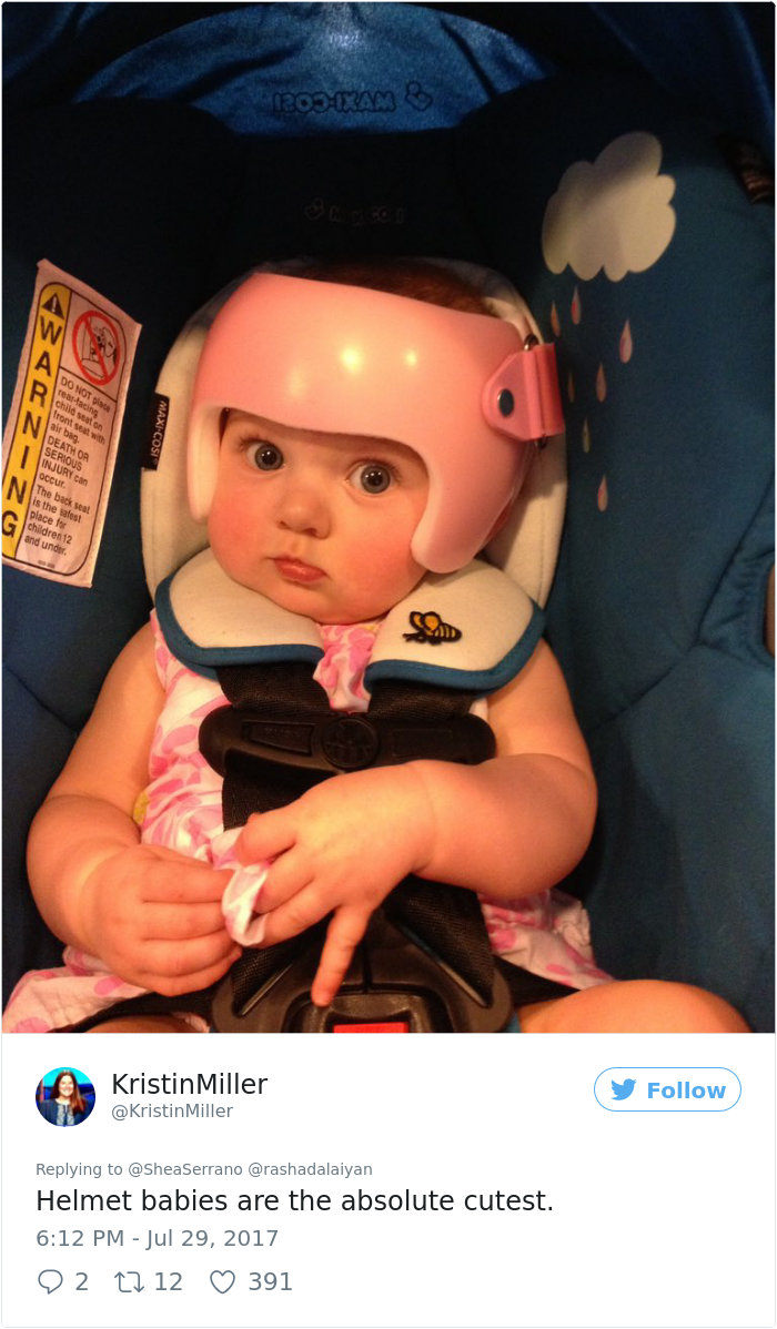 This Baby Has To Wear A Helmet So The Whole Family Decides To Step In This Baby Has To Wear A Helmet So The Whole Family Decides To Step In