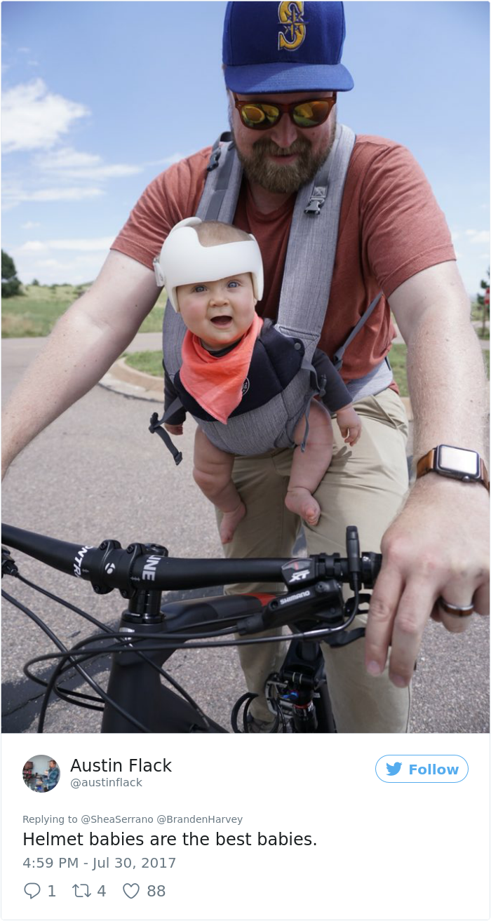 This Baby Has To Wear A Helmet So The Whole Family Decides To Step In This Baby Has To Wear A Helmet So The Whole Family Decides To Step In