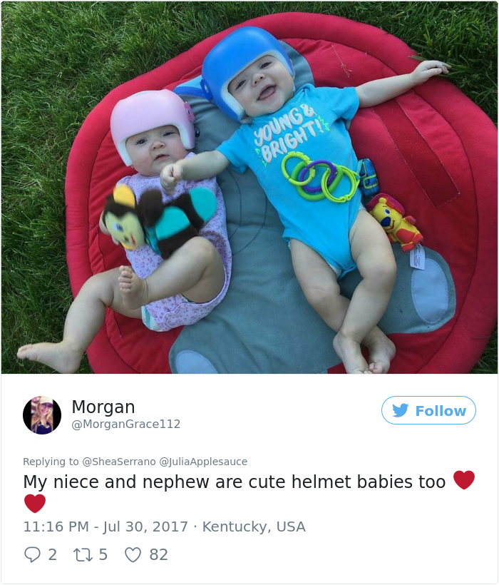 This Baby Has To Wear A Helmet So The Whole Family Decides To Step In This Baby Has To Wear A Helmet So The Whole Family Decides To Step In