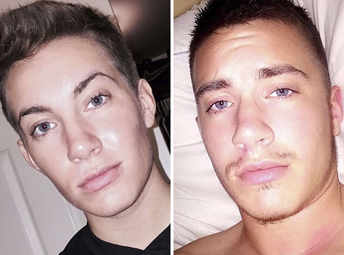 Before And After: Jamie Wilson’s Female-To-Male Transition Photos