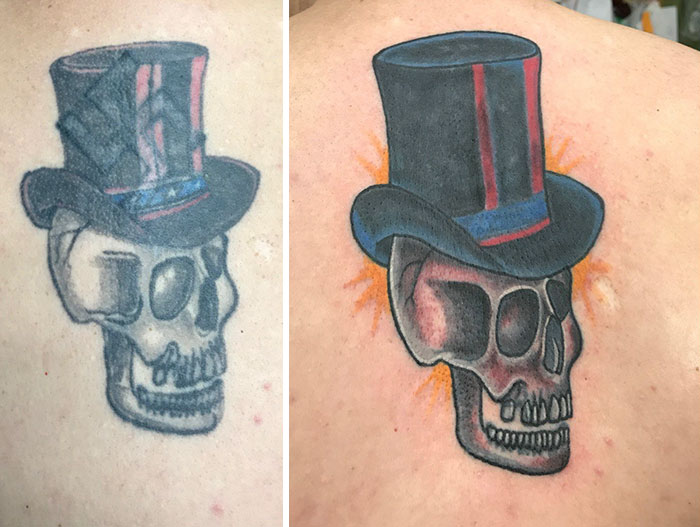 You Can Now Remove Your Racist Tattoos For Free At This Tattoo Parlor, And Here’s 10 Before &#038; After Examples