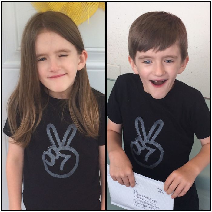 Share Before & After Pics Of Your Extreme Haircut Transformations Share Before & After Pics Of Your Extreme Haircut Transformations