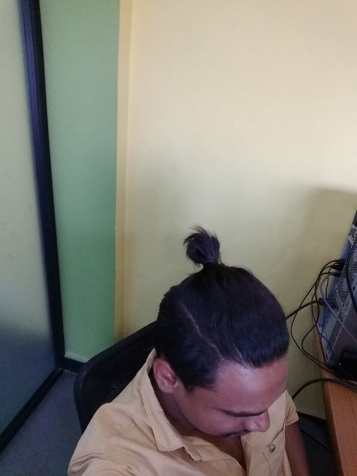 Share Before & After Pics Of Your Extreme Haircut Transformations Share Before & After Pics Of Your Extreme Haircut Transformations