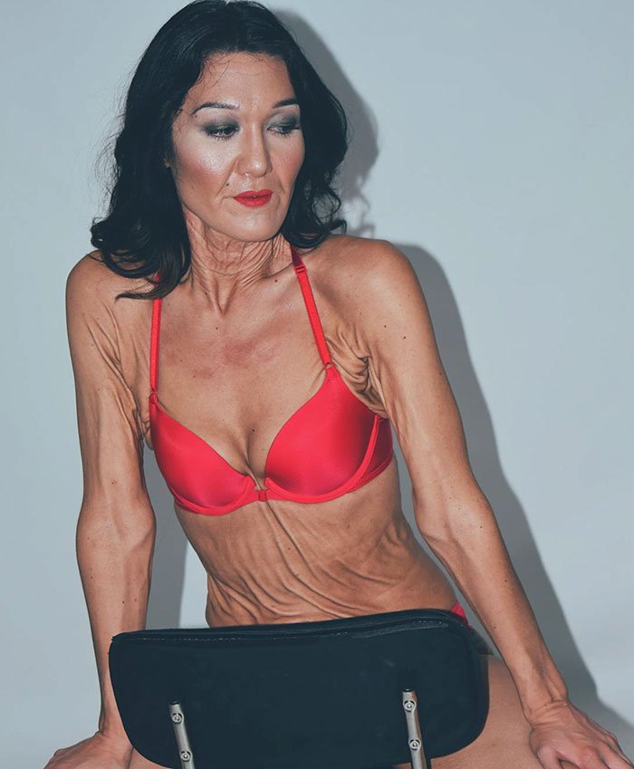 This 26-Year-Old Woman Is Changing The Way We Think About Beauty Standards This 26-Year-Old Woman Is Changing The Way We Think About Beauty Standards