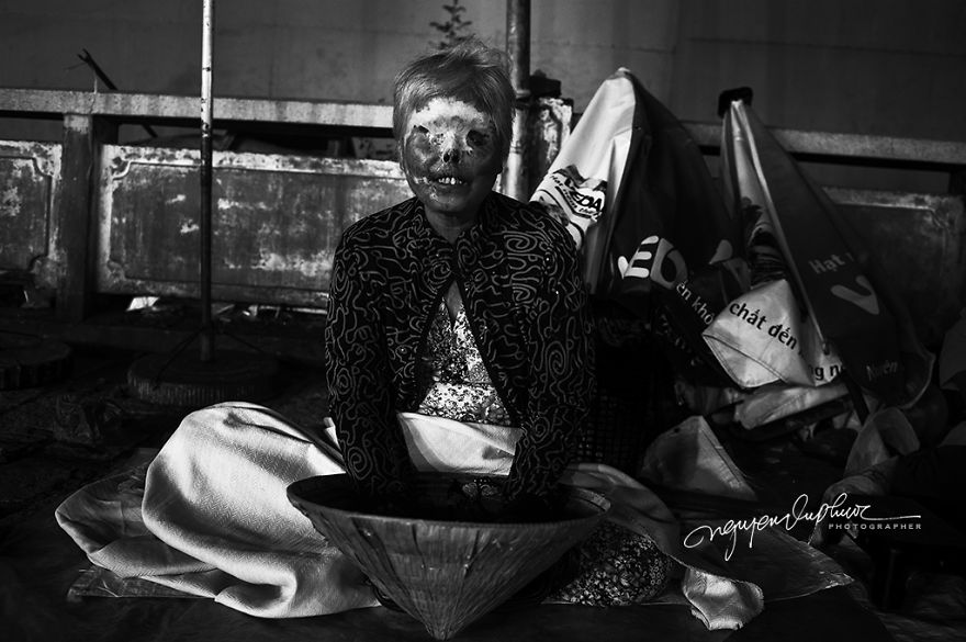 More Brutal Than Death Reality Of Acid Burn Victims Of Vietnam More Brutal Than Death Reality Of Acid Burn Victims Of Vietnam