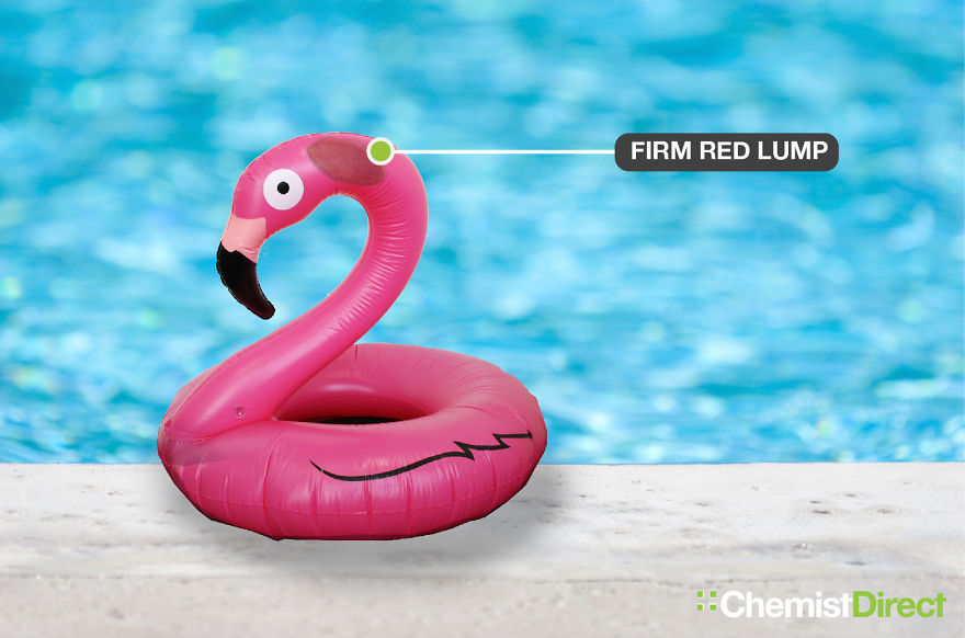 Skin Cancer On Inflatables: 8 Of The Most Common Symptoms Of Skin Cancer