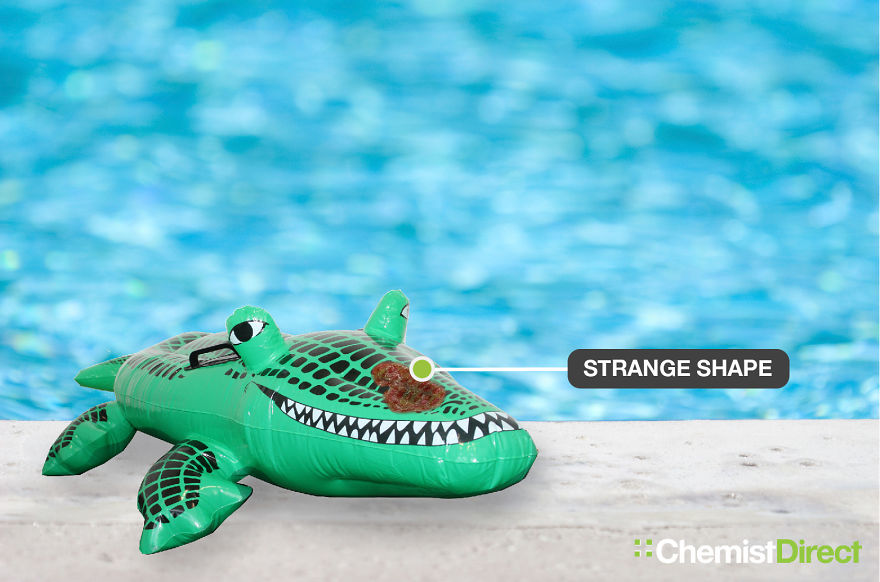 Skin Cancer On Inflatables: 8 Of The Most Common Symptoms Of Skin Cancer