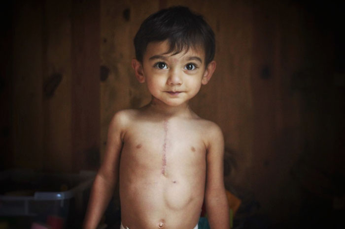 Mom Shares Her Son&#8217;s Crazy Surgery Bill To Show What Will Happen Under Trumpcare