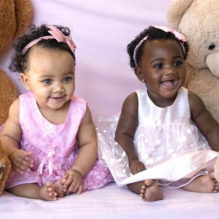 Girls Born In Different Colors Make It Nearly Impossible To Tell They Are Twins Girls Born In Different Colors Make It Nearly Impossible To Tell They Are Twins