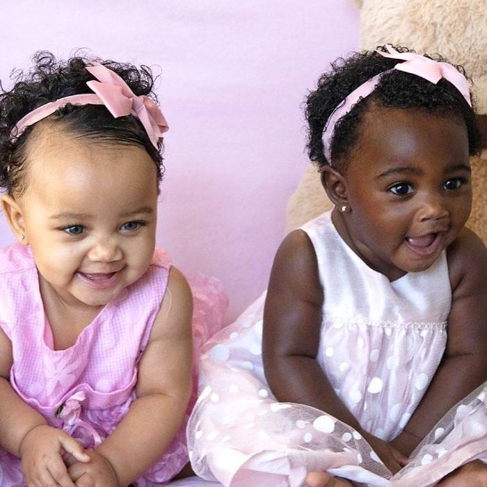 Girls Born In Different Colors Make It Nearly Impossible To Tell They Are Twins Girls Born In Different Colors Make It Nearly Impossible To Tell They Are Twins