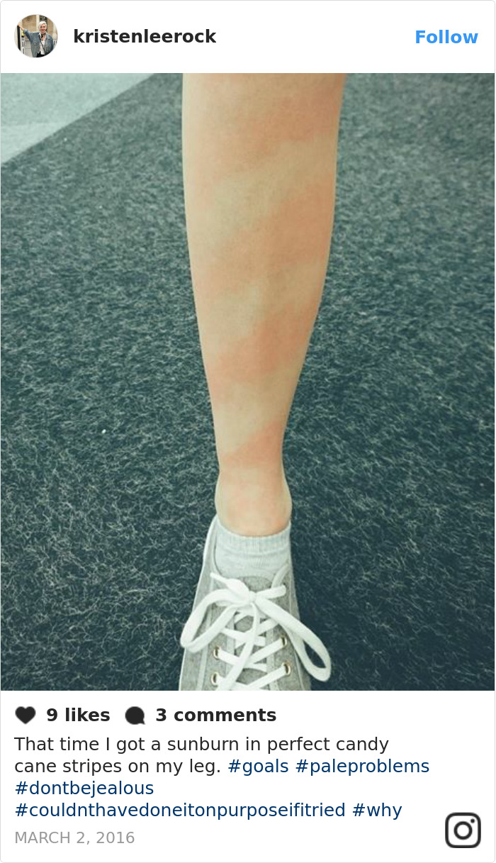 60 Funny Pale People Problems That Other People Will Never Understand 60 Funny Pale People Problems That Other People Will Never Understand