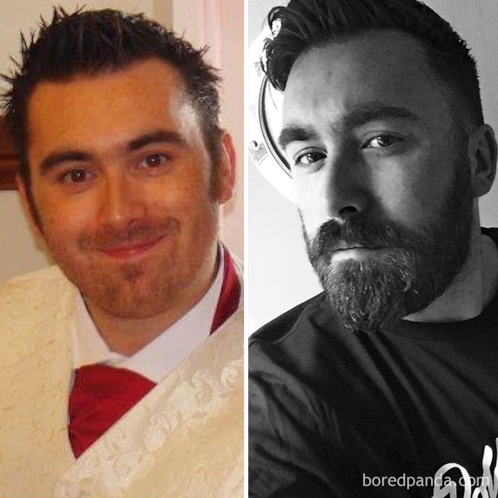 30 Before &#038; After Pics That Will Make You Reconsider Shaving Your Beard