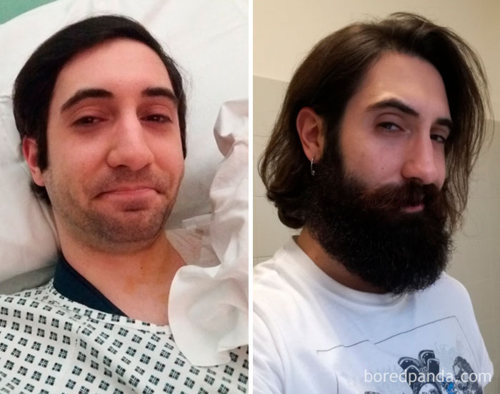 30 Before &#038; After Pics That Will Make You Reconsider Shaving Your Beard