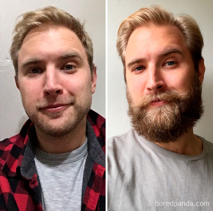 30 Before &#038; After Pics That Will Make You Reconsider Shaving Your Beard